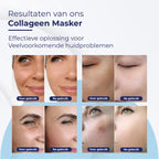 Bio-Collagen Gezichtsmasker 9 Stuks – Korean Beauty Collageen Mask – Hyaluronzuur Masker - afbeelding 3