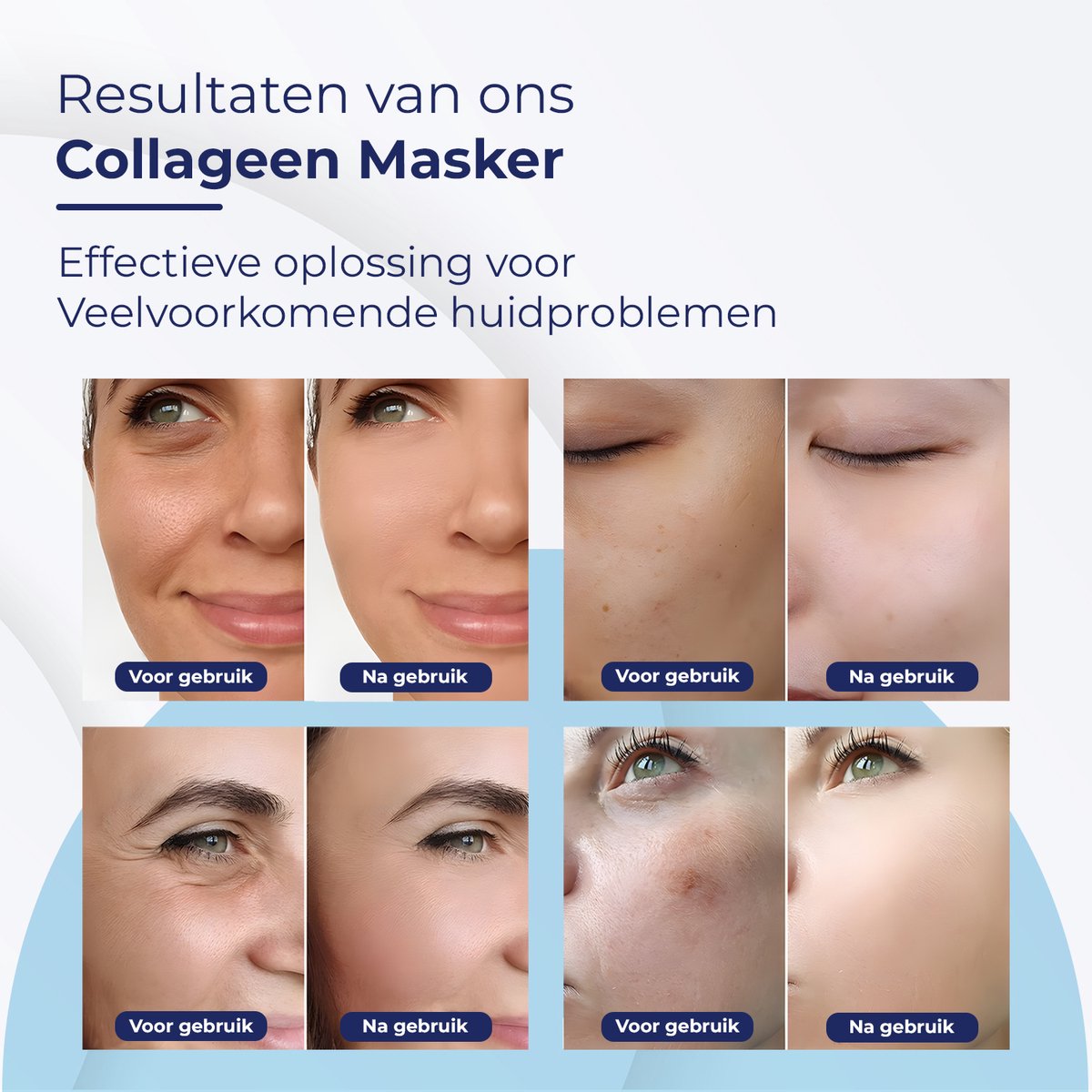 Bio-Collagen Gezichtsmasker 9 Stuks – Korean Beauty Collageen Mask – Hyaluronzuur Masker - afbeelding 3