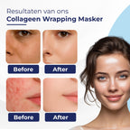 Collageen Wrapping Makser - Bio-Collagen Gezichtsmasker - Korean Beauty Mask – Hyaluronzuur - Night - afbeelding 5
